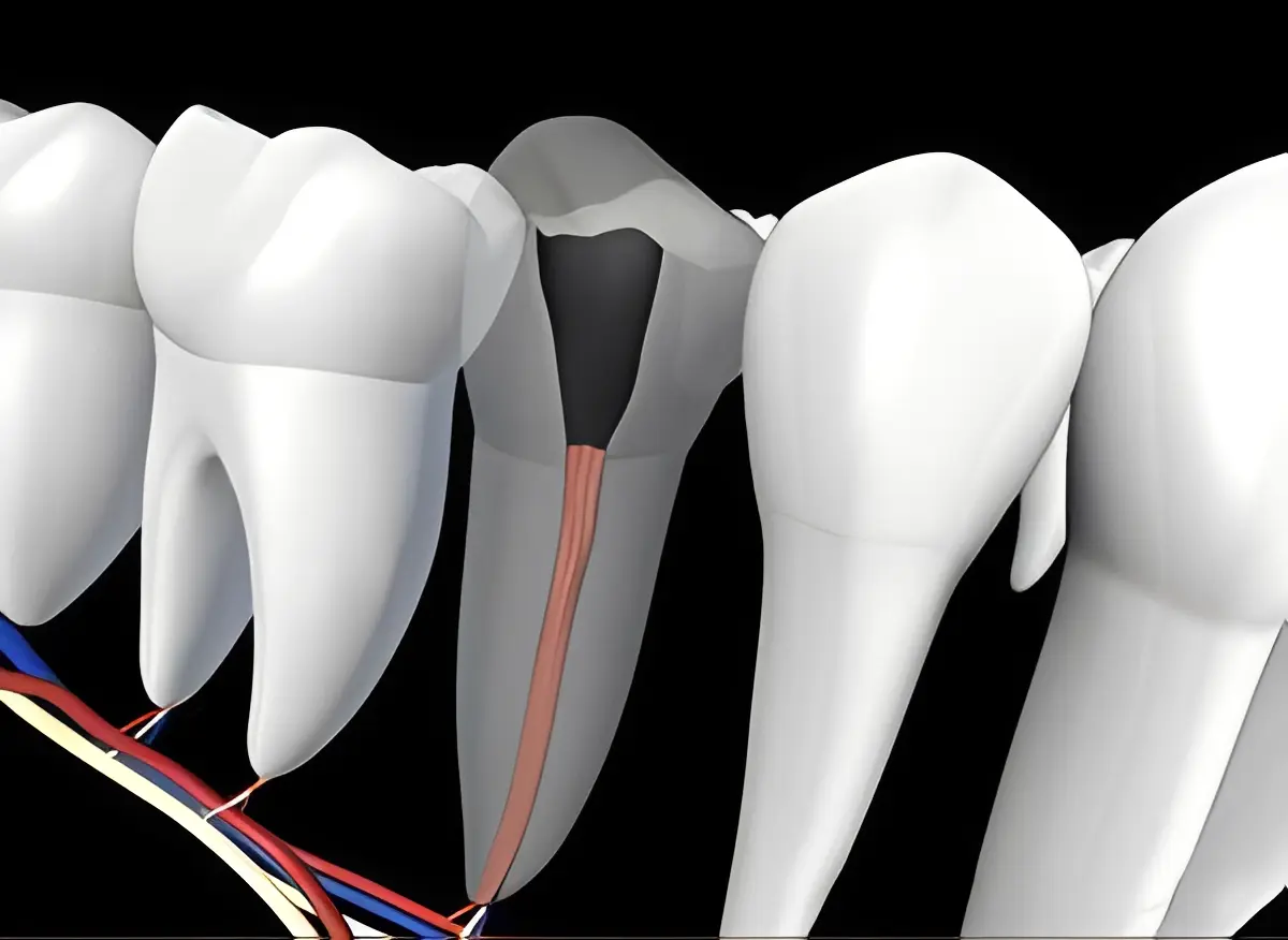 Tooth cross-section showing root canal and nerve