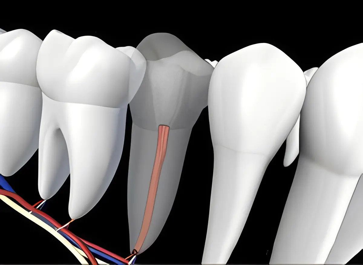 Tooth cross-section showing root canal and nerve