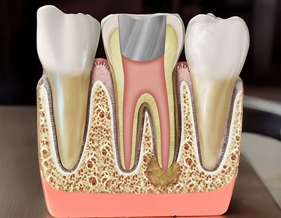 Tooth cross-section dental model showing root canal