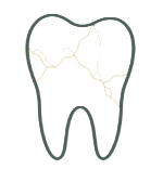 Cracked tooth illustration on black background.