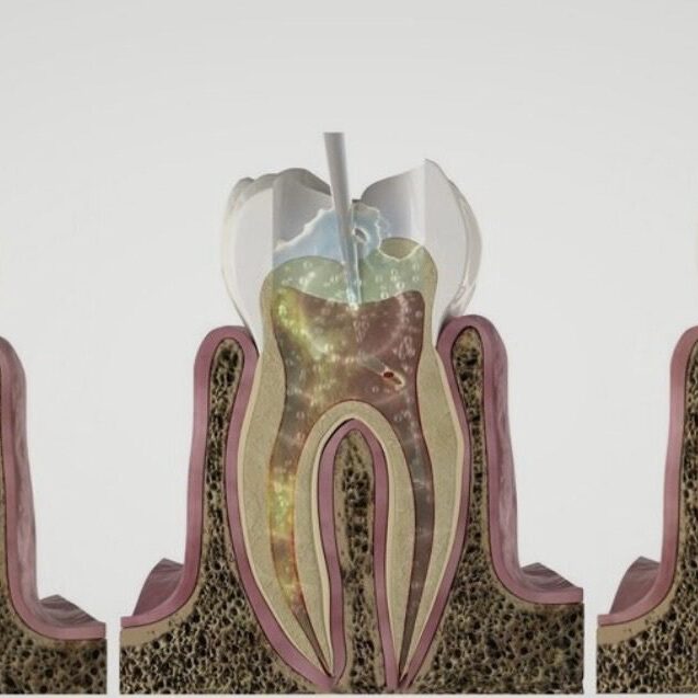 Diagram showing types of tooth root